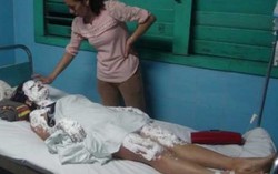2 loại bóng bay cực nguy hiểm dễ cháy nổ