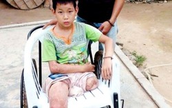 Mất chân vì xe tải