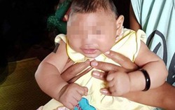Việt Nam ghi nhận em bé đầu tiên mắc chứng đầu nhỏ do virus Zika
