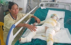 Vụ 3 bé mầm non bị bỏng nặng: 'Nhìn cháu quấn đầy băng, tôi không cầm được nước mắt'