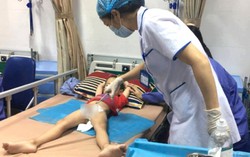 Bác sĩ nói gì về số trẻ cắt bao quy đầu bị sùi mào gà ở Hưng Yên
