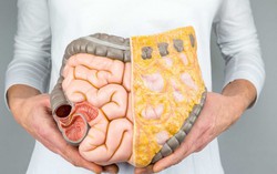 Cẩn trọng với bệnh xuất huyết tiêu hóa khi thời tiết giao mùa