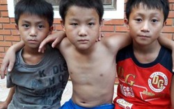 Cậu bé xin cắt chân đã bình phục hoàn toàn 