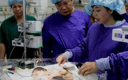 Cặp song sinh dính liền chưa thể mổ tách