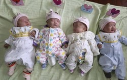 Ca sinh tư đặc biệt nhất thế giới