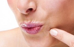 Mách chị em 7 cách trị mụn cóc hiệu quả mà không hề tốn kém