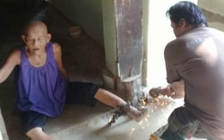 Hàng xóm sốc khi thấy cụ bà 83 tuổi bị xích chân đến bật máu trước cửa nhà