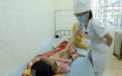 Đồng Nai: Bệnh sởi đang tăng mạnh 