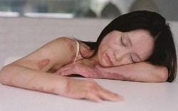 Cô gái bị tẩm xăng đốt đang đợi tình yêu
