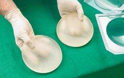 Miếng độn nâng ngực silicon dễ dẫn đến chẩn đoán sai bệnh tim 