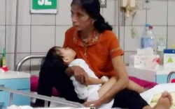 Bé gái 3 tuổi hoại tử chân vì bị rắn hổ mang bò vào nhà cắn 