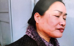 Thanh Trì, Hà Nội: Người dân bị đánh, chính quyền thờ ơ?