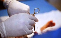  80 trẻ bị sùi mào gà sau khi cắt bao quy đầu ở phòng khám tư