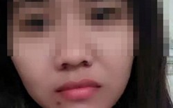 Cô dâu Việt kêu cứu vì chồng tâm thần người Trung Quốc đánh đập