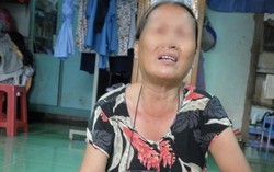 Tâm sự của người vợ suýt chết vì bị chồng giẫm ngang cổ họng 