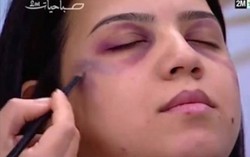 Phẫn nộ với show truyền hình hướng dẫn trang điểm che dấu vết bạo hành