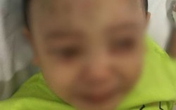 Bà ngoại bé 1 tuổi nghi bị bạo hành đề nghị điều tra, làm rõ