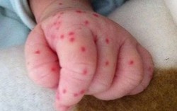 Bé gái tử vong, gia đình nói do sốc thuốc, Sở Y tế bảo không