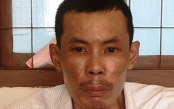 Cho rằng bị 'dạy khôn', nửa đêm chồng tẩm xăng đốt vợ