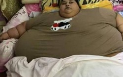 Người phụ nữ nặng nhất thế giới phẫu thuật để bỏ 400kg