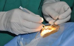 Va vào cánh hoa giấy, bé 6 tuổi bị rách giác mạc