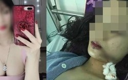 Cô gái xinh đẹp bị rạch mặt ở Bắc Ninh do mâu thuẫn cá nhân