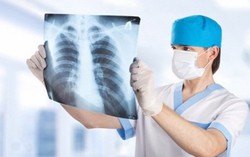 Tiến bộ mới trong điều trị ung thư phổi không tế bào nhỏ