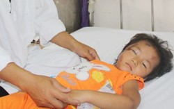 Bé trai ngã thang bị nứt sọ
