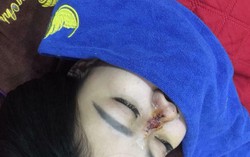 Vụ phẫu thuật hỏng mũi: Sở và phòng Y tế "đá bóng" trách nhiệm?