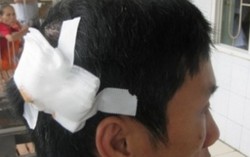 Chồng tố bị nhân tình của vợ đánh nứt sọ