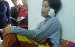 Lĩnh án tù vì bạo hành, cắt tai vợ cũ