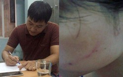 Tài xế bạt tai cô gái trên phố chính thức xin lỗi nạn nhân