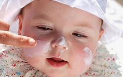 Thận trọng khi dùng thuốc chứa corticoid cho trẻ