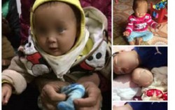 Kết luận vụ bé gái tử vong sau tiêm vaccine ở Phú Thọ