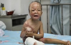 Những điều mẹ cần biết để không làm trẻ bị bỏng khi tắm