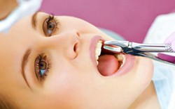 Nữ bệnh nhân suýt chết vì nhổ răng