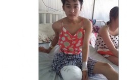 Đình chỉ bác sĩ tắc trách khiến nữ sinh cưa chân