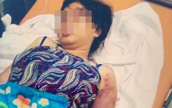 Hội LHPN TPHCM thăm, hỗ trợ người phụ nữ bị tra tấn đến sảy thai