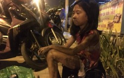 Bộ Y tế huy động lực lượng cứu chữa nạn nhân vụ cháy tại TPHCM