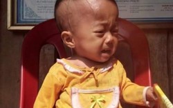 Nguy cơ mất 2 con liên tiếp vì bệnh thiếu máu huyết tán