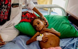 Bé gái gây chấn động thế giới về nạn đói ở Yemen đã qua đời