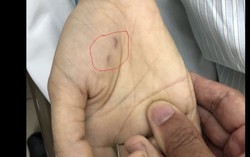 Chủ quan, nữ bác sĩ thú y tử vong vì bị chó dại cắn