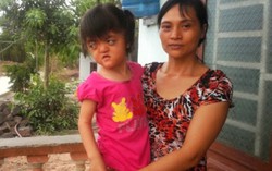 Bé gái 6 tuổi mang khuôn mặt bà lão