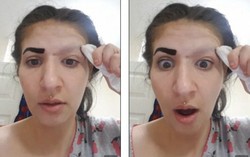 Cô gái trụi lông mày vì sử dụng sai gel xăm 
