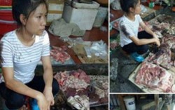 Người phụ nữ bị hắt dầu luyn lên phản thịt "mong không ai bị bắt"