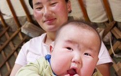 Béo phì đáng báo động, người Mông Cổ nỗ lực cắt giảm khẩu phần ăn