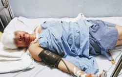 Hà Nội: Vờ bị truy sát, xông vào nhà nghỉ chém bà chủ