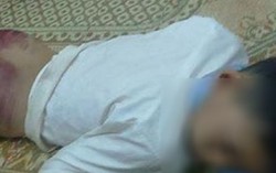 Đừng vội phán xét bé trai bị bố đánh dập mông