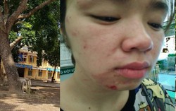 Một phụ nữ tố bị bố mẹ chồng cũ hành hung tại sân trường khi đón con