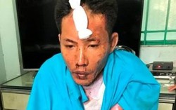 Chồng phóng hỏa đốt vợ và 2 con gái tại phòng trọ
